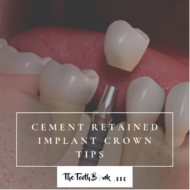 Cement Retained Implant Crowns - The Tooth Bank